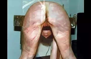 ដំណើររោគវិទ្យា