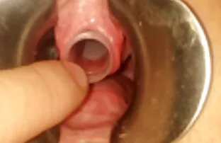 លេងសំបុកឃ្មុំ ១២