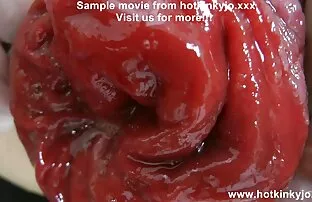 កែងដៃជ្រៅនិងរន្ធគូថជ្រៅ