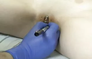 ចោះ ១