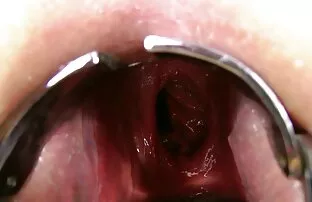 ចម្ងាយស្ទង់រន្ធគូថទ្វេដង